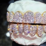 The Complex Trend Of  diamond dust grillz For Your Teeth.
